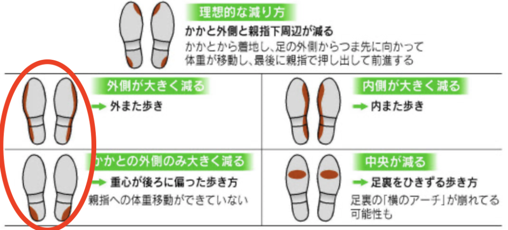 ベット 廃棄 鳥 靴 かかと 外側 減る 対策 Marumiya M Jp